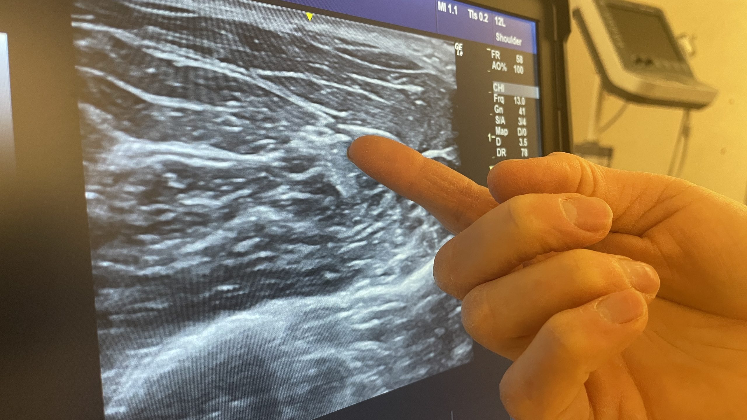 ”Den stora fördelen med ultraljud är att man kan röra på kroppsdelen